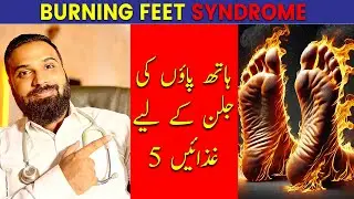 BURNING FEET SYNDROME | Hatho paon ki jalan ka ilaj by Dr Mujtaba.