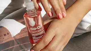 Is Bio-Oil a Miracle Oil | Honest Review by a Mommy Of 2