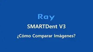 SMARTDent V3: &iquest;C&oacute;mo Comparar Im&aacute;genes?