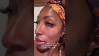 24K Gold Eye Mask - Puffy Eyes And Dark Circles