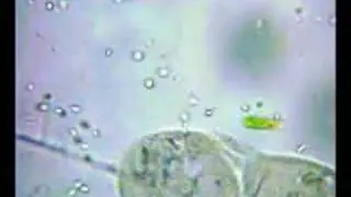 Paramecium Dividing