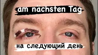 На следующий день после операции / am n&auml;chsten Tag nach der OP