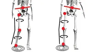 PAILS/RAILS Internal Rotation of Tibia