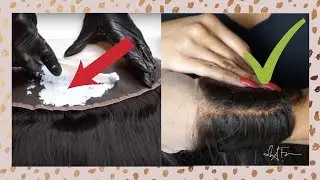 ✨MAKE YOUR FRONTAL LOOK LIKE SCALP | HOW TO PERFECTLY BLEACH KNOTS ON YOUR FRONTAL
