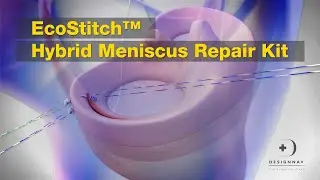OC Ecostitch Meniscus Repair Animation
