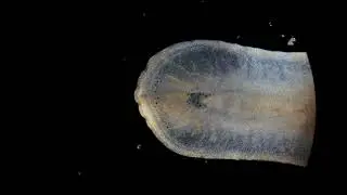 Planaria flatworm? Microscope footage.