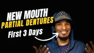 First 3 Days of Wearing Partial Dentures Experience. Be Encouraged. #vlog