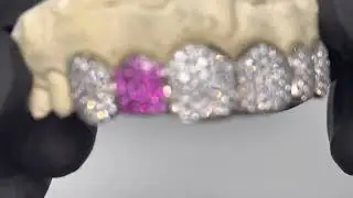 Top 6 Diamond Grillz w Hot Pink Sapphire Tooth | Luxe Grillz