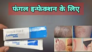 luliconazole cream | Fungal Infection | Lulibrut Cream | khujli ka dawai
