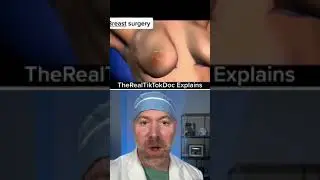 AMAZING Animated Explanation Of Breast Lift With Implants #shorts
