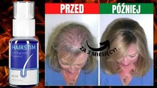 HAIRSTIM OPINIE (Piękno Włos&oacute;w ⚠️) | Hairstim Recenzja | Hairstim