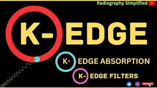 K-edge ll K- Absorption edge ll K-edge Filters ll Radiography simplified ll