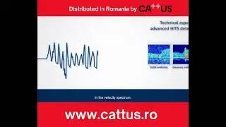 TCD embolus detection