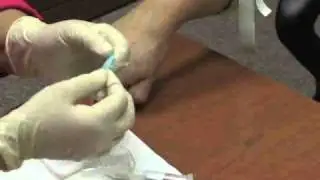 Home Health Skills Part 11 - Peripheral Lab Draw with Butterfly II