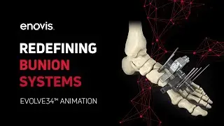 Evolve34&trade; Animation