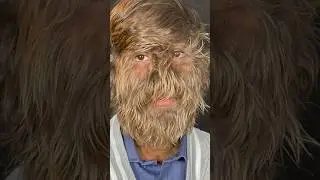 World's HAIRIEST man 😮