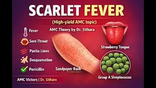 Scarlet Fever – One Topic That Always Appears in AMC