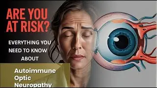 Autoimmune Optic Neuropathy Explained Causes, Symptoms and Treatment, All Insights