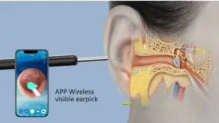 NATFIRE NE3 Ear Cleaner High Precision Ear Wax Removal Tool with LED Camera
