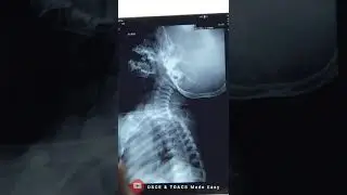 ENT X-Rays by Dr. Ihtesham Part 2 | TOACS | OSCE | 4th Year | MBBS