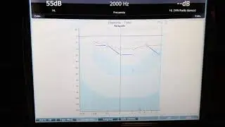 Tutorial Audiómetro AC40 4