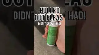 DIY Commercial Home Flea Killer Worked in 24 Hours
