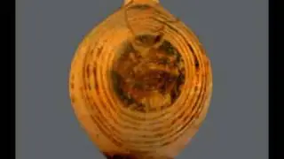 Aryballos