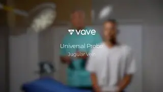 Vascular Ultrasound with the Vave Universal Probe | Jugular Vein