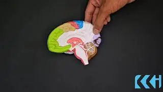 Kay Kay Industries Coloured Brain Model Half