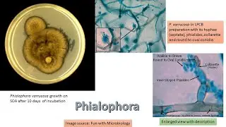 Phialophora Verrucosa dematiaceous darkly pigmented fungus causative agents of chromoblastomycosis