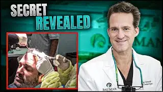 The SECRET Behind Long-Lasting PRP Results