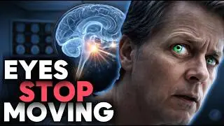 Progressive Supranuclear Palsy: The Brain That Can No Longer Look or Move