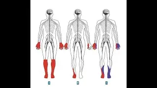 Neurologie Medicale - Neuropathies Peripheriques [FMPC]