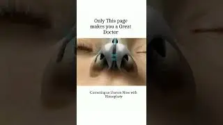 Correcting an uneven nose with Rhinoplasty 😱😱🔥#neet #aiimsmbbs #biology #aiims #reels #shorts