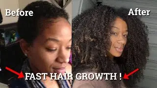 Grow HAIR FAST! Stop Hair Loss & Regrow Damaged Hair Naturally