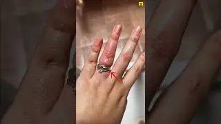 How to Remove a Ring Stuck on Your Finger #shorts