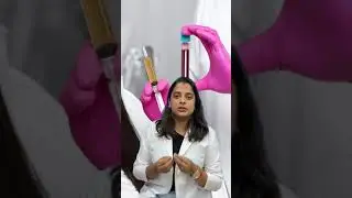 PRP Benefits | Advance Hair India | Hair Restoration Technique | Hair PRP