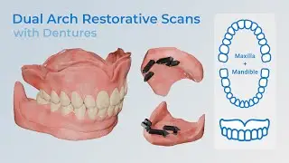 Restorative Full-Arch Protocol from Denture: Dual Arch Case