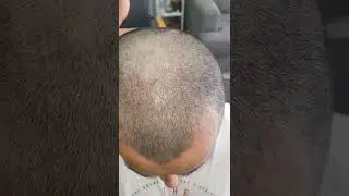 Sar 😯Ki khushki 🔥khatm Karne Ka 💈Tarika#shorts #barbershop #dandruf