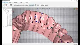 CERIK3D- O3D v6.0- Segmentaci&oacute;n MANUAL- Orchestrate3D- Alineadores Transparentes+AI-AREA3D -video 2