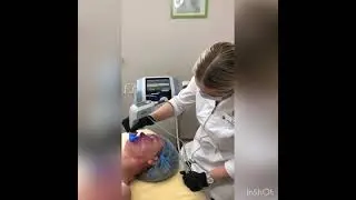 Процедура лифтинга на новом инновационном аппарате EXILIS ELITE!