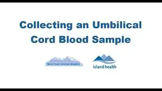 Collecting a Umbilical Cord Blood Sample