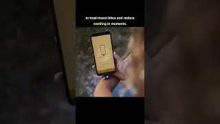 Healing insect bites with a phone #shorts
