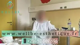 Abdominoplastie avec Liposuccion  - Témoignage - WellBe Esthétique