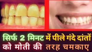 how to yellow teeth become white in hindi | how to yellow teeth white | pile dant kaise saaf kare