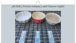 BME 147 Paper based Microfluidic Analytical Device Using Colorimetric Detection