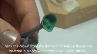 Occlusion Spray