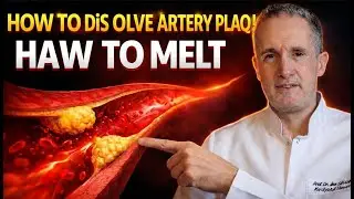 How Do We Dissolve Plaque in Arteries? | Aging Health