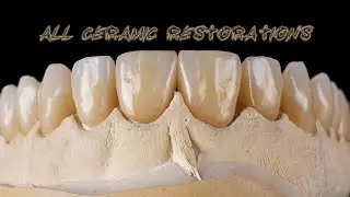 All ceramic restorations | part 1