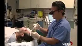NeoGraft Hair Transplant Procedure on GlobalTV Toronto | SpaMedicaTV